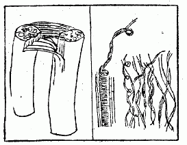「第五図　（右）蓮の糸　（左）ハイネを折りたる状」のキャプション付きの図